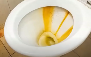 what causes yellow stains on toilet seat